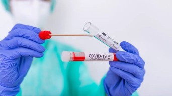 Covid-19 Kembali Merebak di Asia, Kemenkes Keluarkan Surat Edaran Waspada