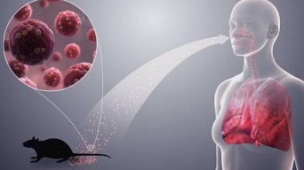 Warga Bandung Positif Virus Hanta, Apa Saja Gejalanya?