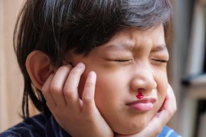 Anak Sering Mimisan? Jangan Panik, Simak Cara Mengatasinya